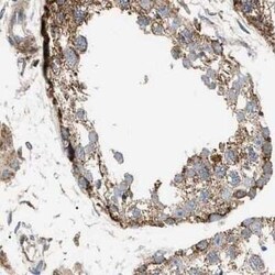 OXSM Antibody, Novus Biologicals 0.1 mL | Buy Online | Novus Biologicals | Fisher Scientific