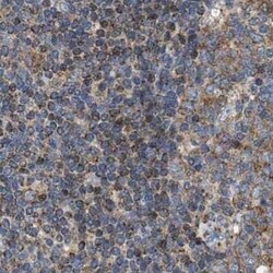 OXSM Antibody, Novus Biologicals 0.1 mL | Buy Online | Novus Biologicals | Fisher Scientific