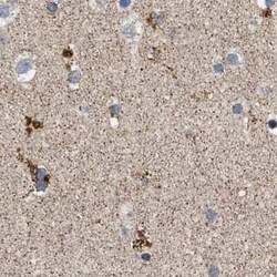 OXSM Antibody, Novus Biologicals 0.1 mL | Buy Online | Novus Biologicals | Fisher Scientific