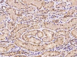OXSM Antibody, Novus Biologicals:Antibodies:Primary Antibodies