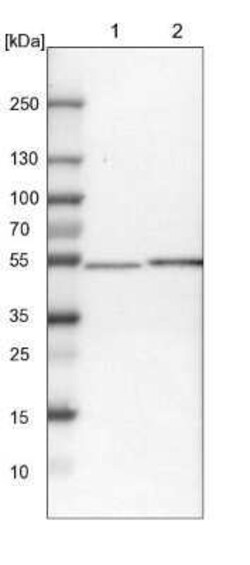 OXSM Antibody, Novus Biologicals 0.1 mL | Buy Online | Novus Biologicals | Fisher Scientific