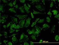 OXSR1 Antibody (2A2-1A2), Novus Biologicals 0.1 mg | Buy Online | Novus Biologicals | Fisher Scientific