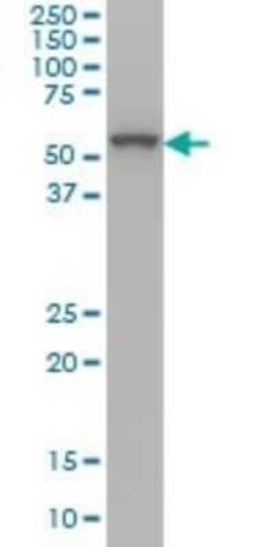 OXSR1 Antibody (2A5), Novus Biologicals 0.1 mg | Buy Online | Novus Biologicals | Fisher Scientific
