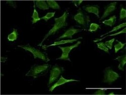 Occludin Antibody (5A7), Novus Biologicals 0.1 mg | Buy Online | Novus Biologicals | Fisher Scientific