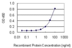 Olfactomedin-1/Noelin-1 Antibody (2G12-1B3), Novus Biologicals 0.1 mg | Buy Online | Novus Biologicals | Fisher Scientific
