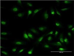 Olig1 Antibody (2B11), Novus Biologicals 0.1 mg | Buy Online | Novus Biologicals | Fisher Scientific