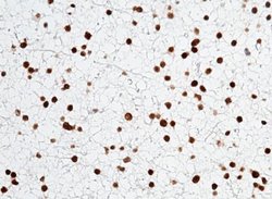 Olig2 Rabbit anti-Human, Clone: 64, Novus Biologicals 100 &mu;g; Unconjugated:Antibodies,