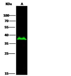 Olig2 Rabbit anti-Human, Clone: 64, Novus Biologicals 100 &mu;g; Unconjugated:Antibodies,