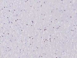 Olig2 Rabbit anti-Human, Clone: OLIG2/6695R, Novus Biologicals 100 &mu;g | Buy Online | Novus Biologicals | Fisher Scientific