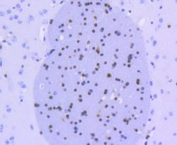 Olig2 Rabbit anti-Human, Clone: SP07-02, Novus Biologicals 100 &mu;L | Buy Online | Novus Biologicals | Fisher Scientific