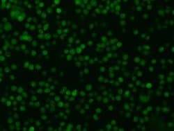 Oncostatin M/OSM Rabbit anti-Human, Clone: 15, Novus Biologicals 100 &mu;g;