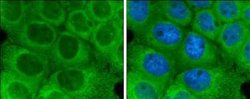 Optineurin Antibody, Novus Biologicals 100 &mu;g; Unconjugated:Antibodies,