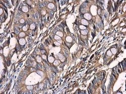 Optineurin Antibody, Novus Biologicals 100 &mu;g; Unconjugated:Antibodies,