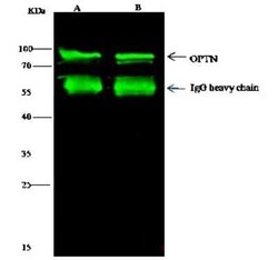 Optineurin Antibody, Novus Biologicals 50 &mu;g | Buy Online | Novus Biologicals | Fisher Scientific