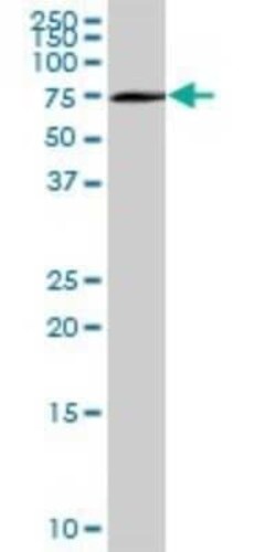 Optineurin Antibody, Novus Biologicals 0.05 mg | Buy Online | Novus Biologicals | Fisher Scientific