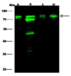 Optineurin Antibody, Novus Biologicals 50 &mu;g | Buy Online | Novus Biologicals | Fisher Scientific