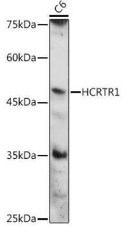 Orexin R1/HCRTR1 Antibody - Azide and BSA Free, Novus Biologicals:Antibodies:Primary
