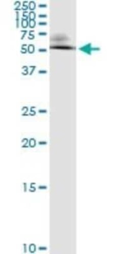 Ornithine Decarboxylase Antibody (2G5), Novus Biologicals 0.1 mg | Buy Online | Novus Biologicals | Fisher Scientific