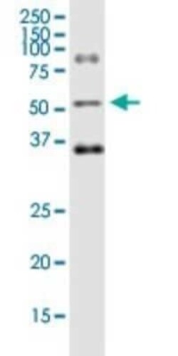 Ornithine Decarboxylase Antibody (2G5), Novus Biologicals 0.1 mg | Buy Online | Novus Biologicals | Fisher Scientific