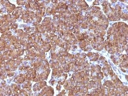 Ornithine Decarboxylase Antibody (ODC1/486), Novus Biologicals 0.1mg; Unlabeled:Antibodies,