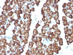 Ornithine Decarboxylase Antibody (ODC1/487), Novus Biologicals:Antibodies:Primary