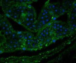 Os01g0847700 Rabbit anti-Plant, Polyclonal, Novus Biologicals 100 &mu;g;