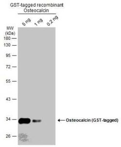Osteocalcin Antibody, Novus Biologicals 100 &mu;g | Buy Online | Novus Biologicals | Fisher Scientific