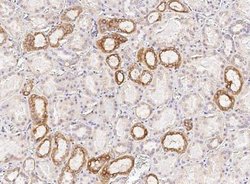 Osteopontin/OPN Rabbit anti-Human, Clone: 1, Novus Biologicals 50 &mu;g;