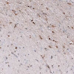 Osteopontin/OPN Antibody (CL10686), Novus Biologicals:Antibodies:Primary