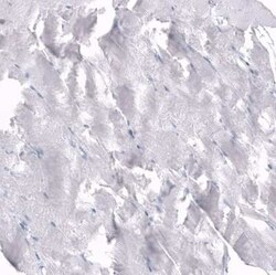 Osteopontin/OPN Antibody (CL10686), Novus Biologicals:Antibodies:Primary