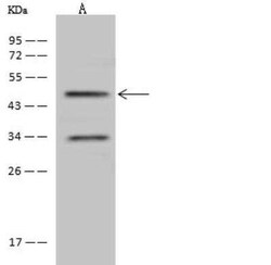 Osterix/Sp7 Antibody, Novus Biologicals 50 &mu;g, Unconjugated:Antibodies,