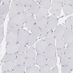 Otubain-2 Antibody, Novus Biologicals 0.1 mL | Buy Online | Novus Biologicals | Fisher Scientific