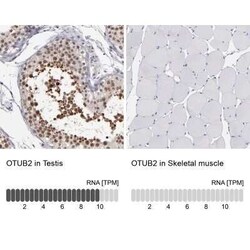 Otubain-2 Antibody, Novus Biologicals 0.1 mL | Buy Online | Novus Biologicals | Fisher Scientific