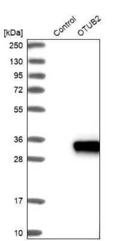 Otubain-2 Antibody, Novus Biologicals 0.1 mL | Buy Online | Novus Biologicals | Fisher Scientific