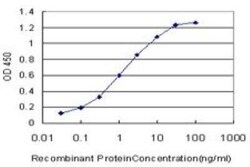 Otx1 Antibody (1F2), Novus Biologicals 0.1 mg | Buy Online | Novus Biologicals | Fisher Scientific