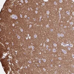 Otx1 Antibody, Novus Biologicals:Antibodies:Primary Antibodies