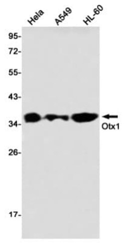Otx1 Antibody (S04-1D1), Novus Biologicals 100 &mu;g; Unconjugated:Antibodies,