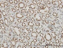P15RS Antibody (1B8), Novus Biologicals 0.1 mg | Buy Online | Novus Biologicals | Fisher Scientific