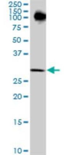 P15RS Antibody (1B8), Novus Biologicals 0.1 mg | Buy Online | Novus Biologicals | Fisher Scientific