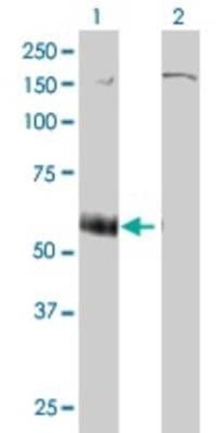 P2X5/P2RX5 Antibody (1C5), Novus Biologicals 0.1 mg | Buy Online | Novus Biologicals | Fisher Scientific