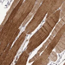 P2X6/P2RX6 Antibody, Novus Biologicals:Antibodies:Primary Antibodies