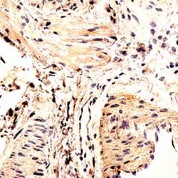P2X7/P2RX7 Antibody (545205), Unconjugated, Novus Biologicals:Antibodies:Primary