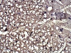 P2Y12/P2RY12 Antibody, Novus Biologicals:Antibodies:Primary Antibodies