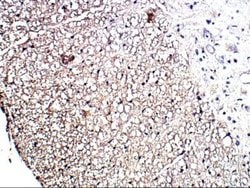 P2Y12/P2RY12 Antibody, Novus Biologicals:Antibodies:Primary Antibodies