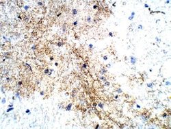 P2Y12/P2RY12 Antibody, Novus Biologicals:Antibodies:Primary Antibodies
