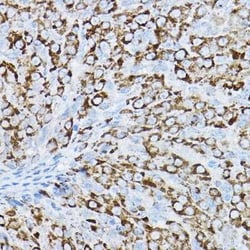 P2Y14/GPR105 Antibody - BSA Free, Novus Biologicals 0.02 mL | Buy Online | Novus Biologicals | Fisher Scientific