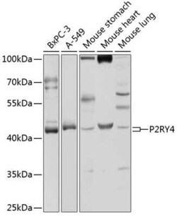 P2Y4/P2RY4 Antibody - BSA Free, Novus Biologicals:Antibodies:Primary Antibodies