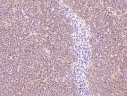 P2Y6/P2RY6 Antibody, Novus Biologicals:Antibodies:Primary Antibodies