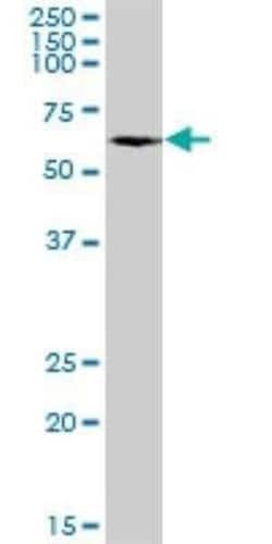 P4HA1 Antibody, Novus Biologicals 0.05 mg | Buy Online | Novus Biologicals | Fisher Scientific