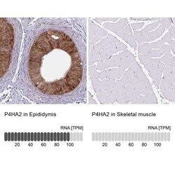 P4HA2 Antibody (CL0351), Novus Biologicals 25 &mu;L, Unconjugated:Antibodies,